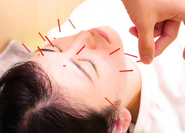 ＮＯＭＯＫＯＴＳＵ鍼灸整骨院　松原商店街院(肌の深層を刺激して、本来持っている力を引き出します。)