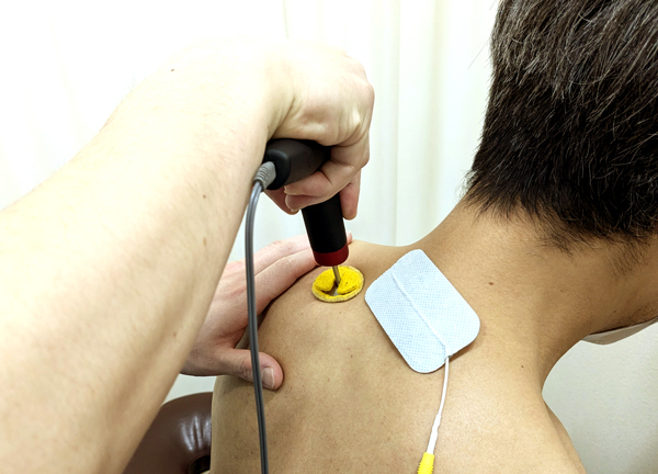 エルフィン北広整骨院【鍼灸】(電気による刺激でお身体の不調を整えます。)