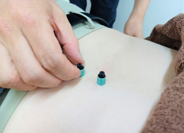 エルフィン北広整骨院【鍼灸】(お灸もお試しください)