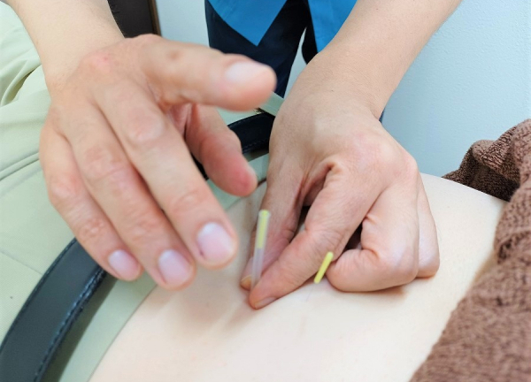 エルフィン北広整骨院【鍼灸】(鍼灸をお試しください)