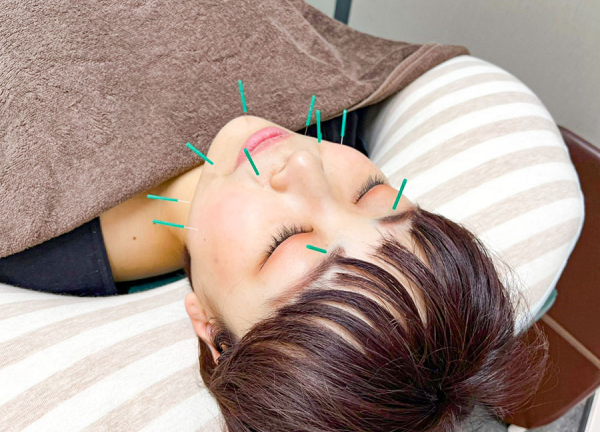 堺整骨院　水巻院(シワ・くすみ・ニキビなどの解消を目指します。)