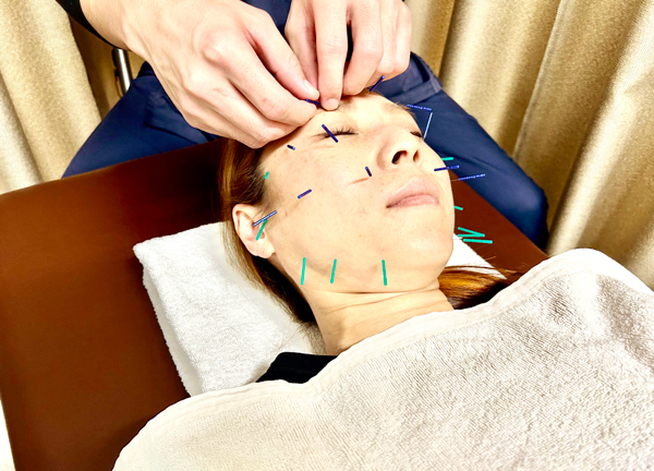 吉祥寺名倉堂接骨院・鍼灸院(お顔のたるみやシワのお悩みもご相談ください。)