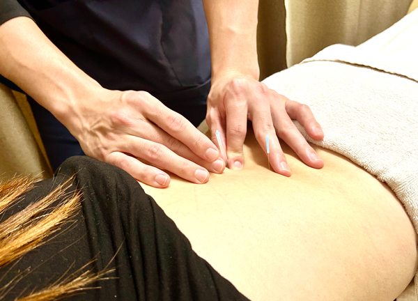 吉祥寺名倉堂接骨院・鍼灸院(局所的な痛みを鍼で緩和いたします。)