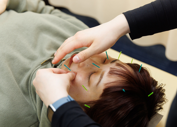 札幌円山あおば鍼灸接骨院(肌深層の細胞を鍼で刺激して潤いを取り戻します。)