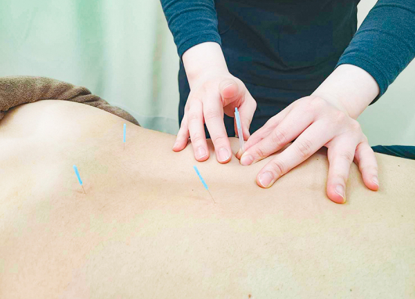 ＫＷＳ鍼灸整骨院　荻窪院(鍼で本来持っている力を引き出していきます)