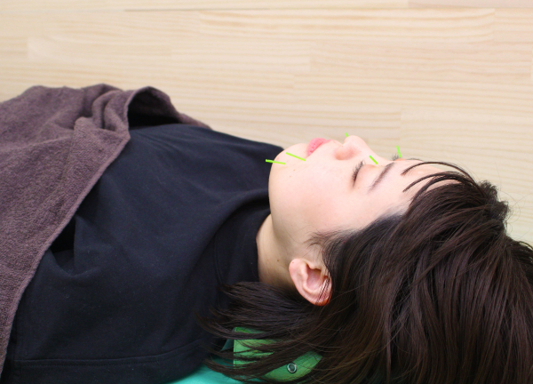 ＮＯＭＯＫＯＴＳＵ鍼灸整骨院　よこはまばし院(お顔周りのシワやくすみは鍼でアプローチします。)