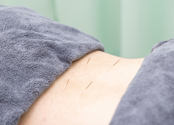 ＮＯＭＯＫＯＴＳＵ鍼灸整骨院　よこはまばし院(鍼灸の力で筋肉弛緩や自律神経の乱れを整えます。)