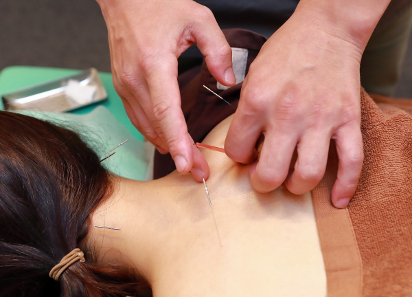 ハリライフ大森鍼灸整骨院(つらい肩こりの解消を目指します。)