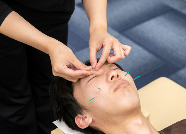 湘南台あおば接骨院はりきゅう院(一本一本丁寧に刺していきます。)