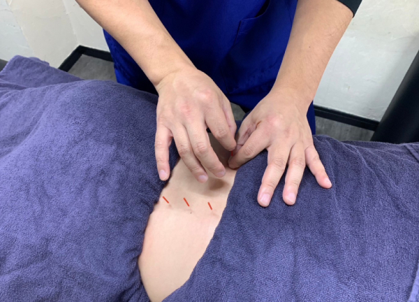 西浦和駅前鍼灸接骨院(手技以外にも鍼やお灸による施術をご用意しています。)