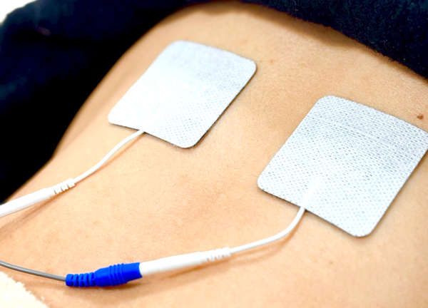 あい鍼灸院・接骨院 仙台ロフト院(電気による刺激で筋肉のコリをほぐします。)