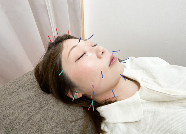 高座渋谷駅鍼灸院・整骨院(美容鍼です。)