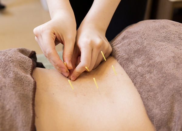 カラダのミカタ鍼灸整骨院　天王寺院(鍼灸で血行促進や自律神経を調整します。)