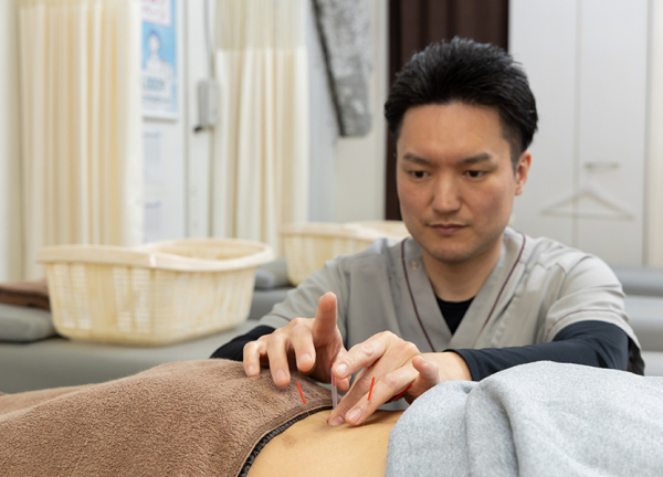 鍼灸で血行促進や自律神経を調整します