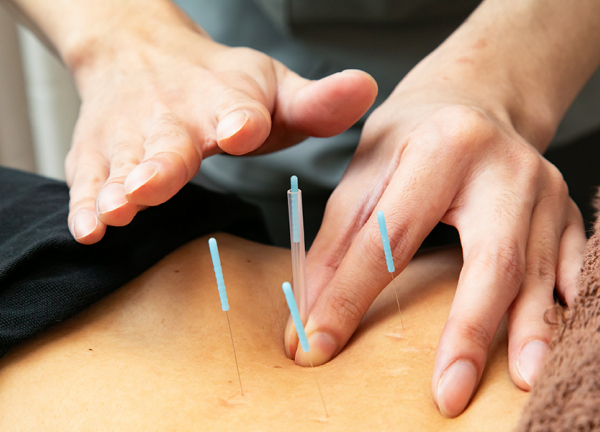 あい鍼灸院・接骨院　ホワイティ梅田院(鍼の力で本来持っている力を引き出します。)