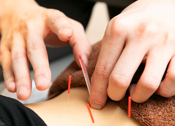 あい鍼灸院・接骨院　心斎橋院(鍼の力で本来持っている力を引き出します。)