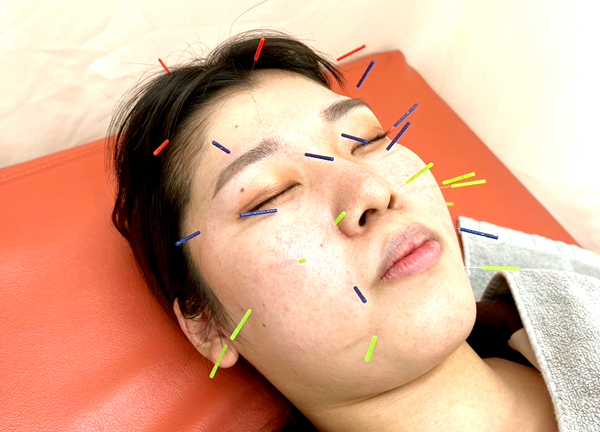 ＧＢＳ巣鴨地蔵通り整骨院・鍼灸院　筋膜整体院(シワやたるみなどお肌のトラブルにもご対応します。)