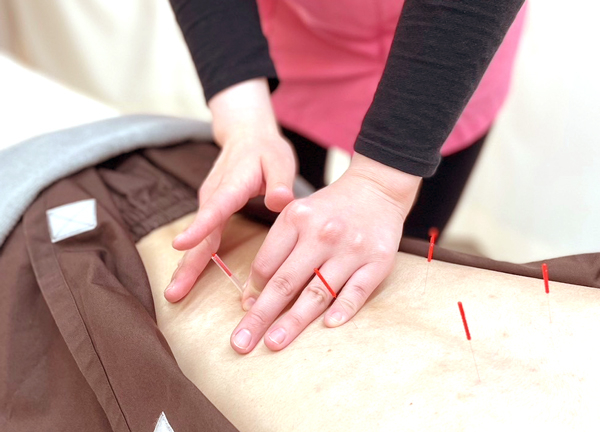 ＧＢＳ巣鴨地蔵通り整骨院・鍼灸院　筋膜整体院(お悩みのある部位にピンポイントでアプローチします。)
