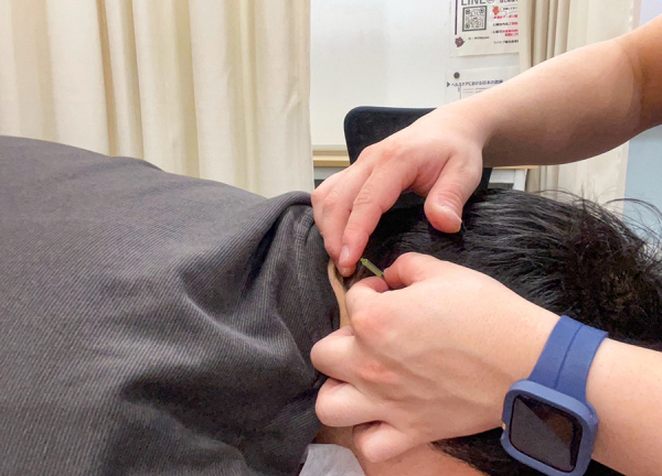 リバイブ鍼灸・接骨院　旗の台院(鍼でお身体を刺激して、お悩みの緩和をおこないます。)