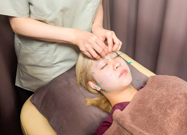 荻窪たんぽぽ整骨院【鍼灸】(施術の様子)