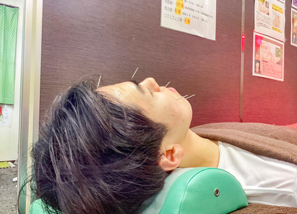 甲斐整骨院　鹿児島天文館院【鍼灸】(頭痛・不眠・お顔まわりのお悩みを緩和します。)