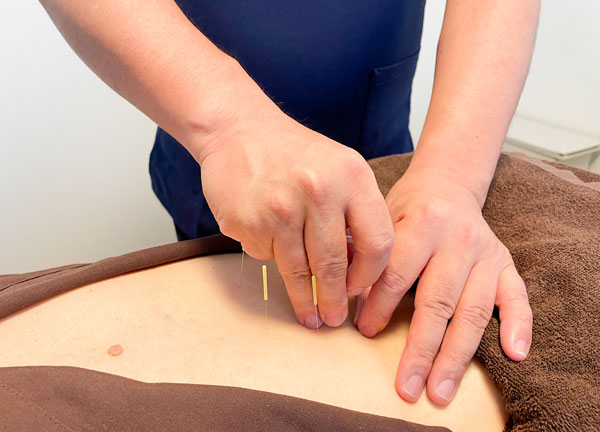 シャローム鍼灸院(腰痛の緩和を目指します。)