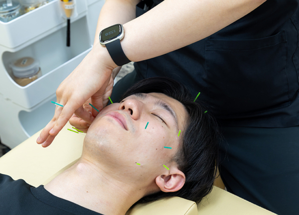 環状通東あおば接骨院・はりきゅう院(深層部のツボを刺激します。)