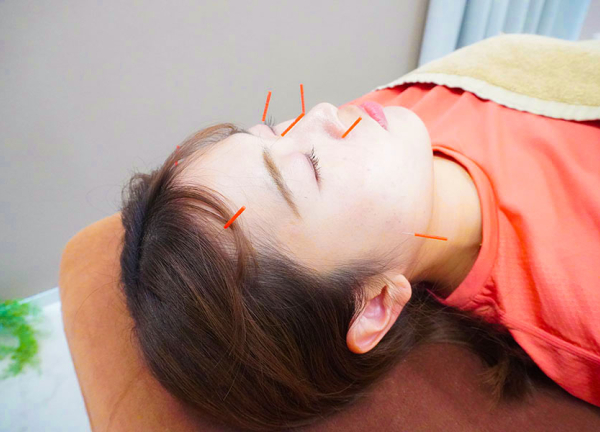 イーライフ鍼灸接骨院　豪徳寺院(肌深層にある筋肉や細胞へアプローチします。)