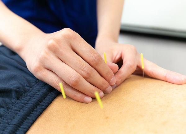 名倉堂鍼灸院・接骨院　ブランチ福岡下原(局所的な痛みを鍼で緩和いたします。)