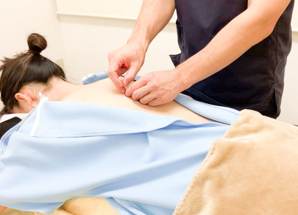 新潟すばる鍼灸・リハビリ整体(鍼の力で痛みの改善を目指します。)