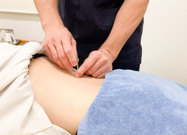 新潟すばる鍼灸・リハビリ整体(長い鍼を使用し、坐骨神経痛の改善を目指します。)