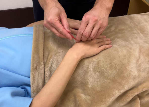 新潟すばる鍼灸・リハビリ整体(局所的な痛みは鍼にお任せください。)