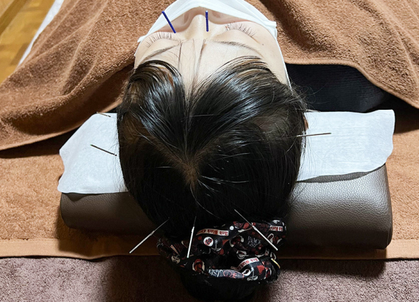 鍼灸治療院　医しん庵　堺市院(体内の流れを整えて健康的なお身体へ。)