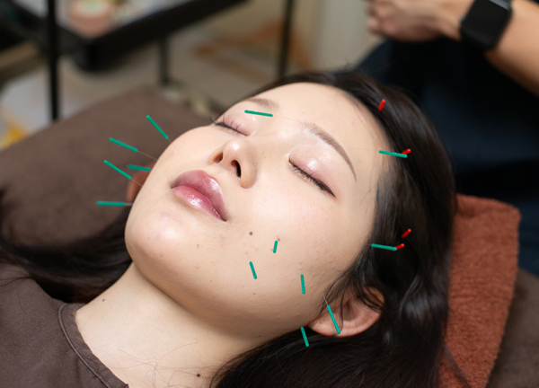 稲田堤たぬき鍼灸整骨院(美容鍼で肌深層にある細胞や深層筋を刺激します。)