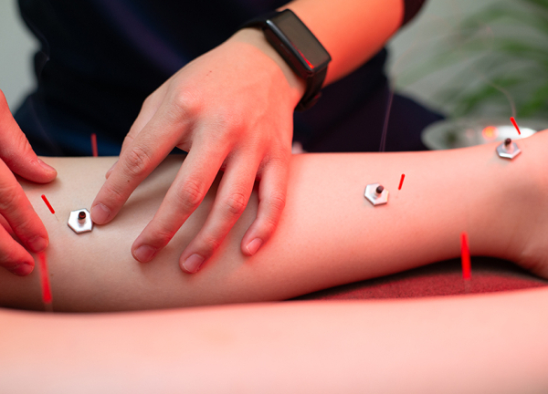 稲田堤たぬき鍼灸整骨院(お灸で自律神経を整えます。)