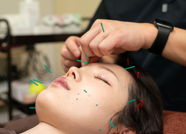 稲田堤たぬき鍼灸整骨院(鍼の力で緊張した筋肉を弛緩します。)