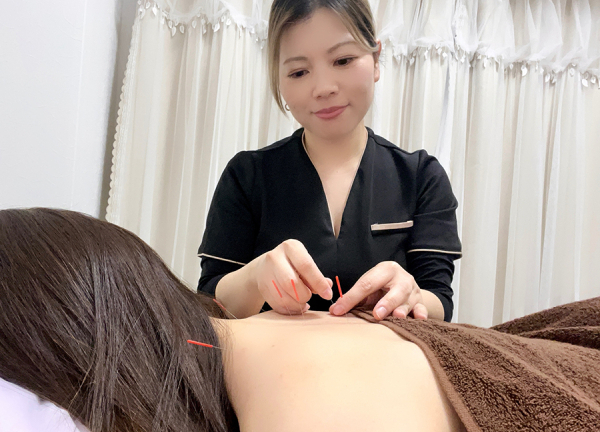 鍼灸アキュティナ（ａｃｕｔｉｎａ）　広島中区院(お客様のお身体に合わせたオーダーメイドの施術をご提供します。)