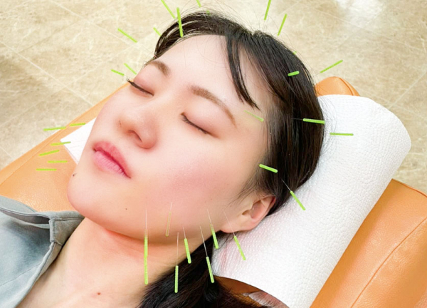 マッサージはりきゅう古河丘里整骨院(美容鍼の力で肌のお悩みの改善を目指します。)