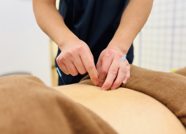 どんぐり鍼灸院・どんぐり接骨院(鍼を用いて深層筋へアプローチします。)