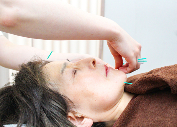 千住大橋駅前はり灸院・整骨院(お顔のツボを刺激して血行や肌のターンオーバーの促進を図ります。)