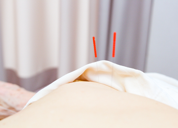 千住大橋駅前はり灸院・整骨院(つらい肩こりの改善を目指します。)