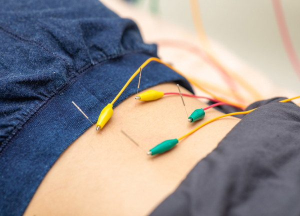 あおば鍼灸院接骨院　フィールアイアイプラザ中川店(鍼灸で本来持っている力を引き出します。)