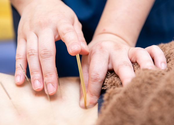 マーサ鍼灸整骨院　山梨学院大学前院(局所的な痛みは鍼でアプローチいたします。)