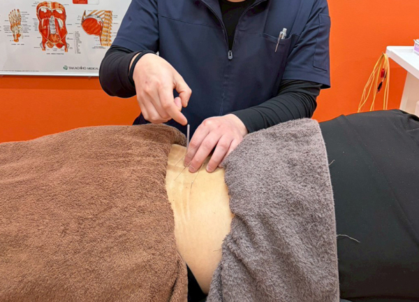 まいれ鍼灸整骨院・整体院　長浜院(鍼灸施術で身体が本来持つ力を引き出します。)