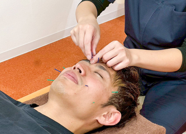 まいれ鍼灸整骨院・整体院　南草津院(美容鍼も対応しています。)