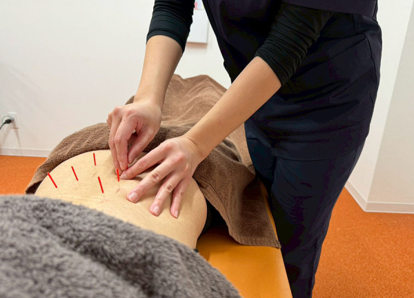 まいれ鍼灸整骨院・整体院　南草津院(鍼灸施術で身体が本来持つ力を引き出します。)
