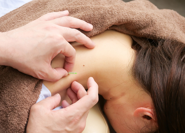ｊｏｙｐｌｕｓ．枚方鍼灸整骨院(気になる箇所へ局所施術が可能です。)