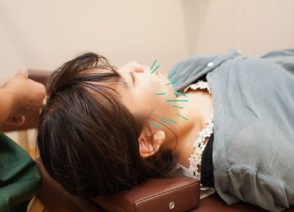 コアの樹　鍼灸接骨院(不眠・睡眠の質・肌トラブル・自律神経の乱れなど、美容鍼で内側からアプローチをおこないます。)