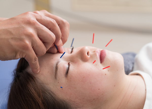 上福岡しらふじ整骨院【鍼灸】(美容鍼でお顔まわりのお悩みの改善を目指します。)